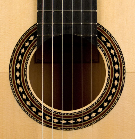 2011 Erez Perelman SP/CY